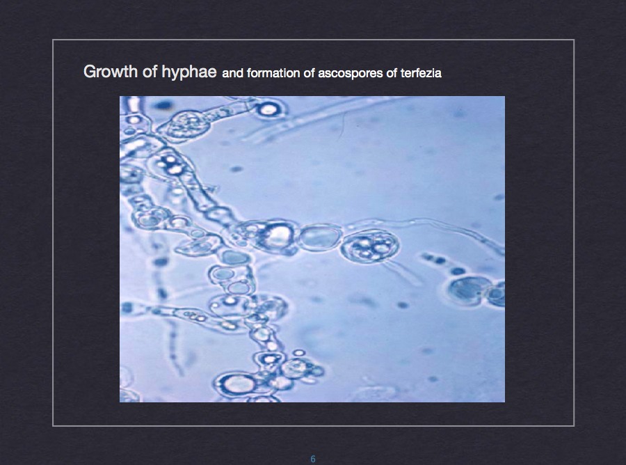 Truffle spore microscopy